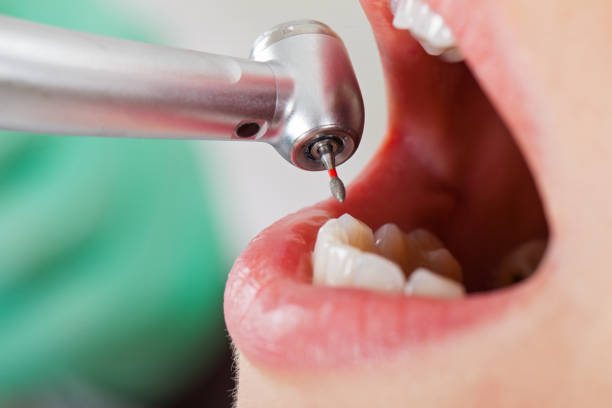 Best Urgent Dental Care for Toothache in Caddo, OK